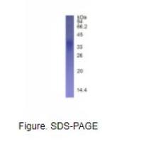 免疫球蛋白关联β(CD79B)真核蛋白