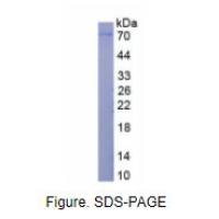 基质金属蛋白酶2(MMP2)真核蛋白