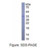 心肌肌钙蛋白I(cTnI)真核蛋白