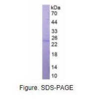 线粒体核糖体蛋白S4(MRPS4)真核蛋白