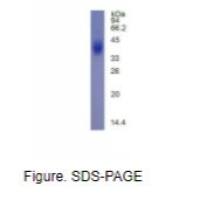 CD42b分子(CD42b)真核蛋白