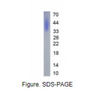 细胞程序性死亡蛋白1配体2(PDL2)真核蛋白