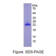 基质金属蛋白酶9(MMP9)真核蛋白