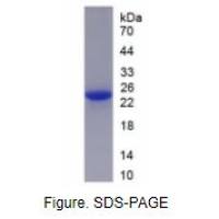 生长激素(GH)真核蛋白