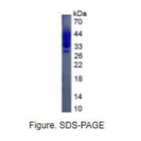 巨噬细胞集落刺激因子(MCSF)真核蛋白