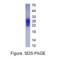 白介素3(IL3)真核蛋白