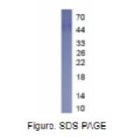 肾损伤分子1(Kim1)真核蛋白