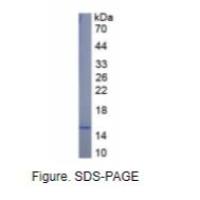 钙卫蛋白(CALPRO)真核蛋白