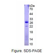 硬骨素(SOST)真核蛋白