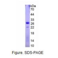 硬骨素(SOST)真核蛋白