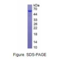 神经纤维网蛋白1(NRP1)真核蛋白