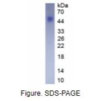 CD56分子(CD56)真核蛋白