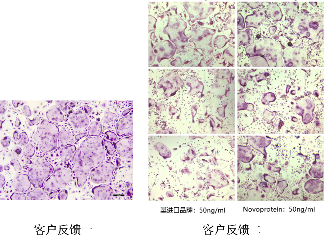 破骨细胞培养-骨科疾病研究必不可少