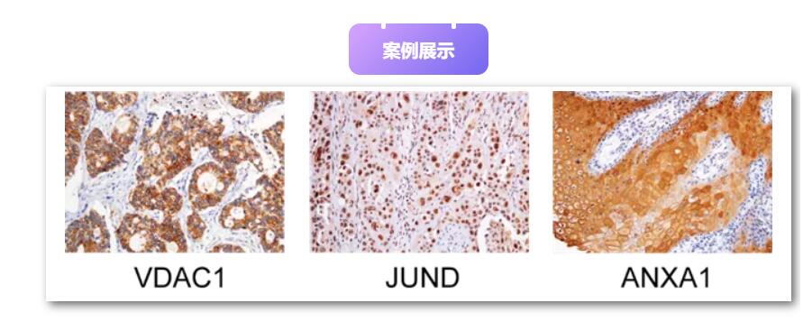 免疫组化常见问题（精选）