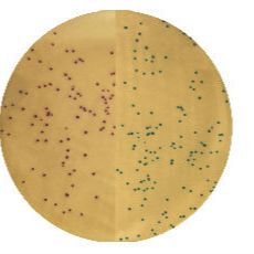 改良 MRSA 显色培养基