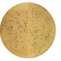 改良 MRSA 显色培养基