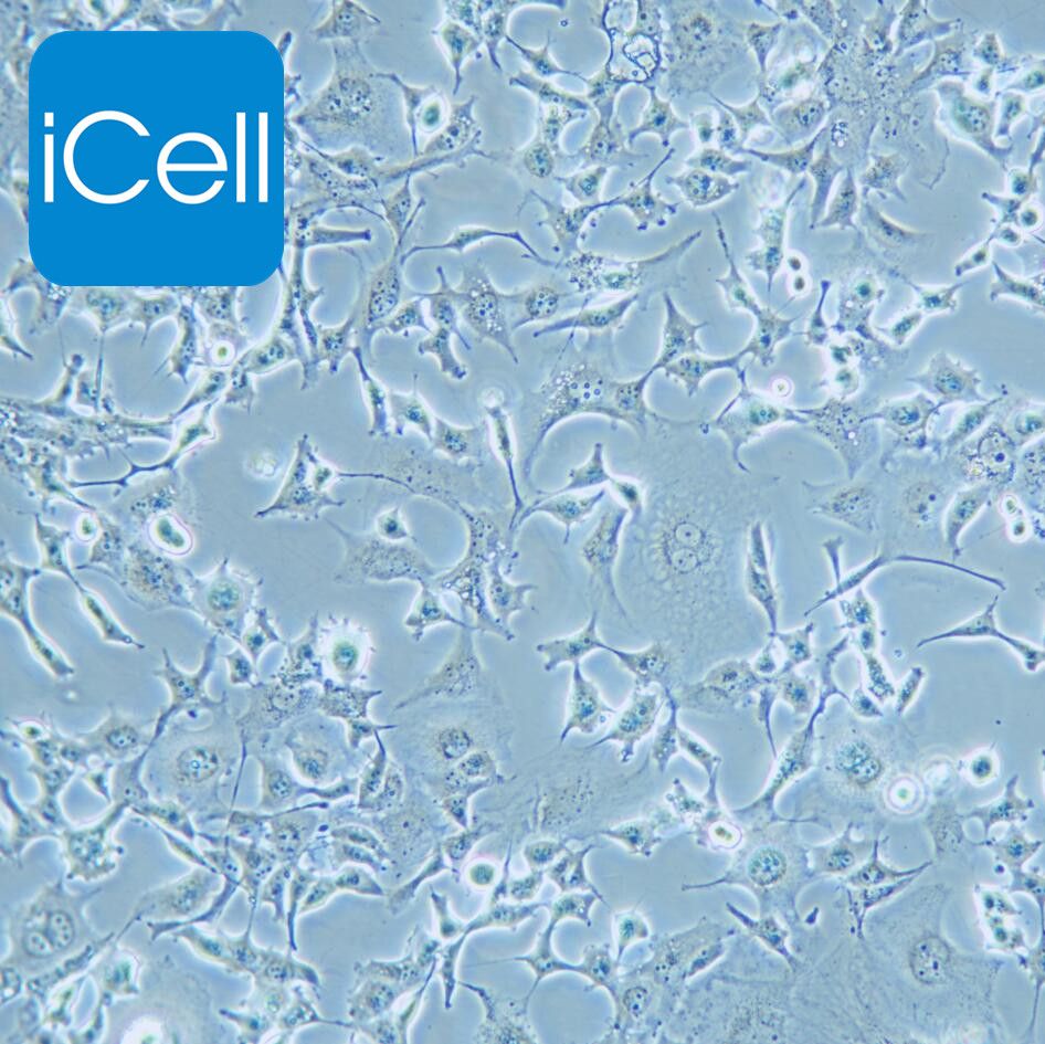 Hs746T 人胃癌细胞/STR鉴定/镜像绮点（Cellverse）