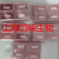 彩色单扩散定量检测板(IgG.IgM.IgA)