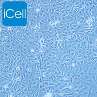 KYSE410细胞 | KYSE-410细胞 | KYSE-410 | KYSE410 | 人食道鳞状癌细胞 | STR鉴定 | 镜像绮点（Cellverse）