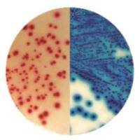 ESBL 显色培养基