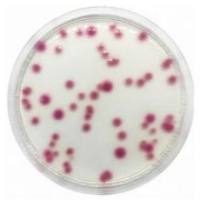 克雷伯菌显色培养基