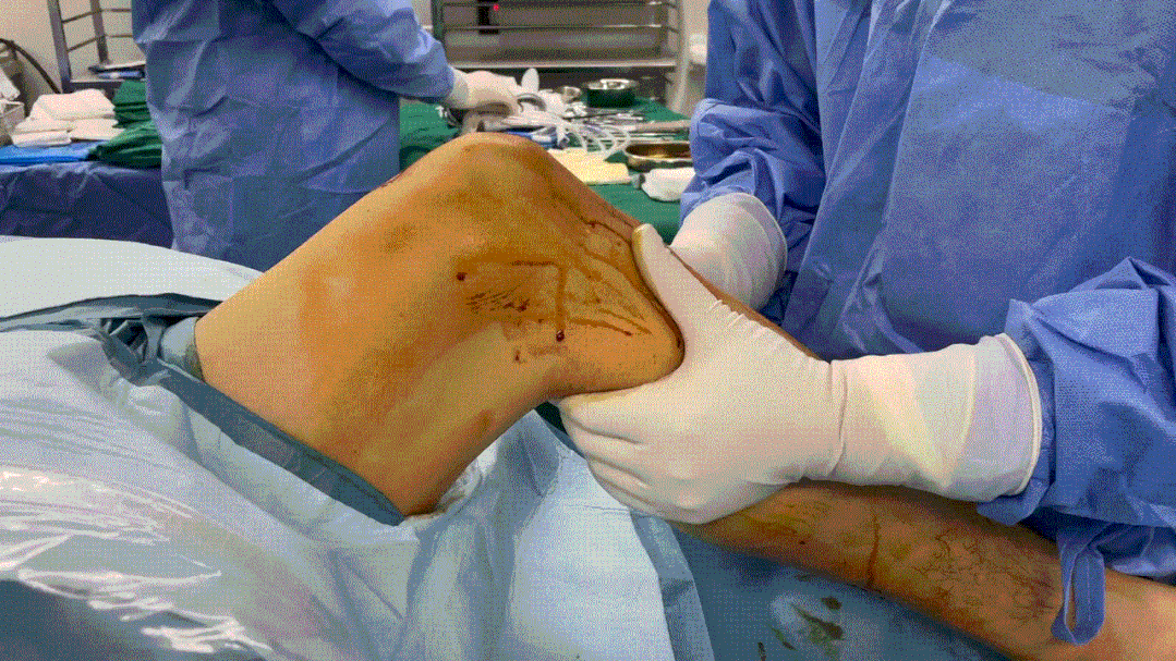 骨科医生看冬奥之关节篇：首当其冲的这个部位压力不比冠军小