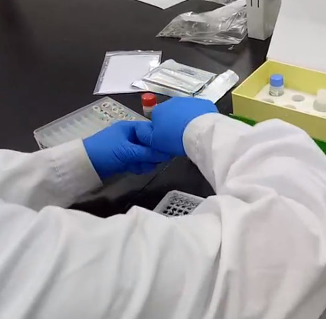 你知道ELISA试剂盒如何检测血清吗