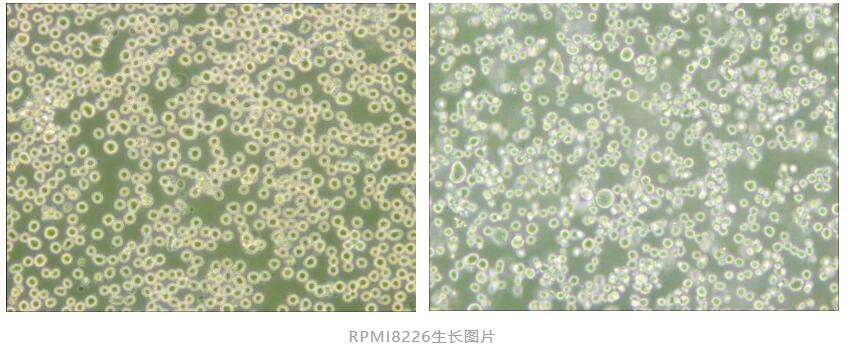 RPMI8226培养易被忽视的问题