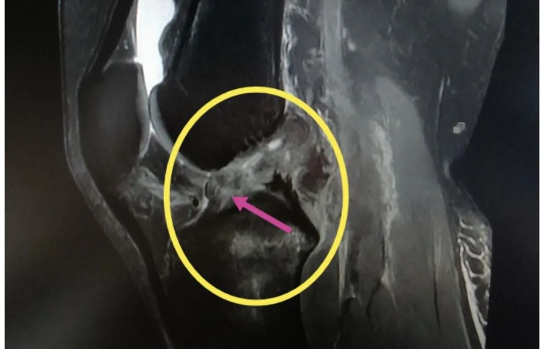 骨科医生看冬奥之关节篇：首当其冲的这个部位压力不比冠军小