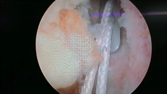 骨科医生看冬奥之关节篇：首当其冲的这个部位压力不比冠军小