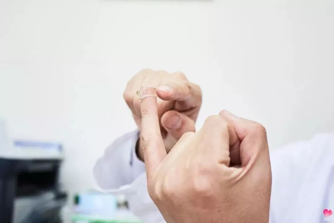 包皮环切术：小儿泌尿外科医生的「精雕细琢」
