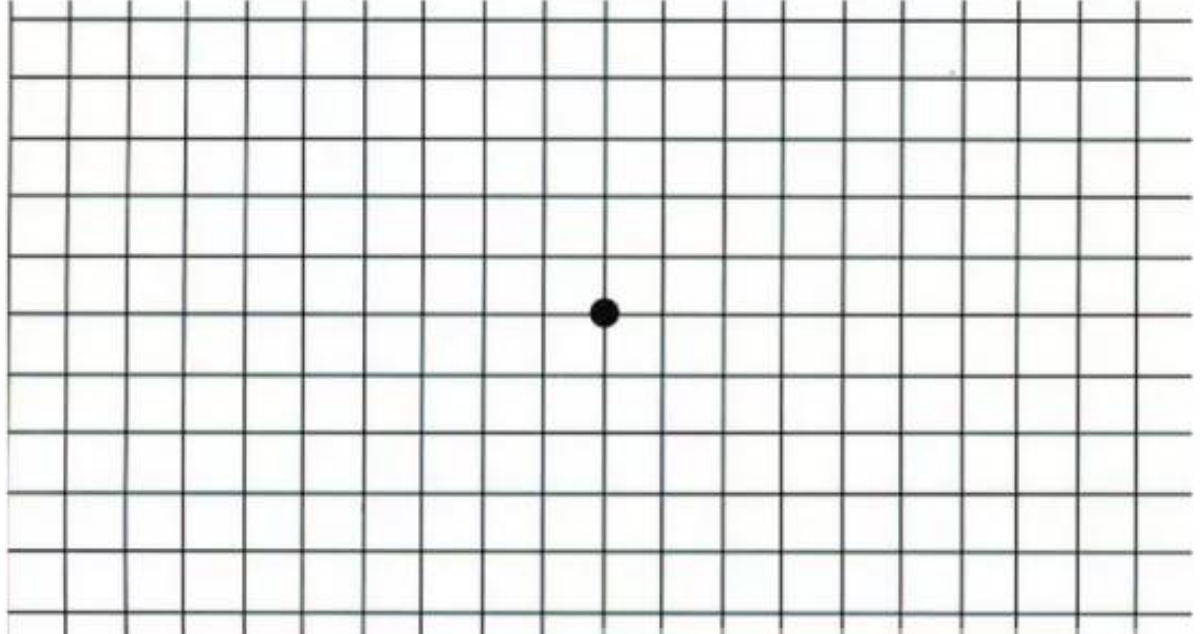 「人生表格」在你眼里扭曲了？警惕黄斑病变！