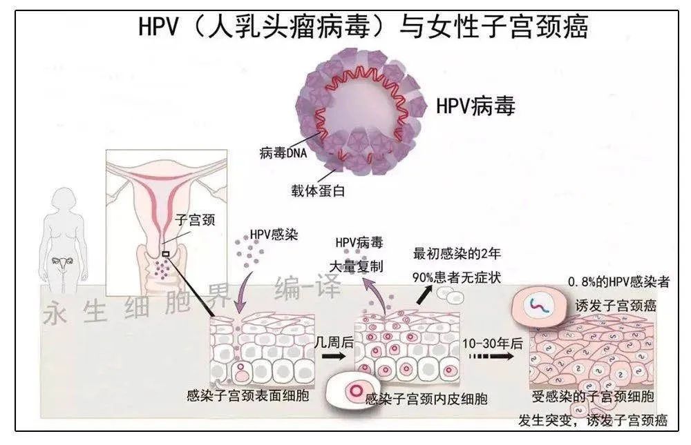 HPV 检查呈阳性，我是不是得宫颈癌了？