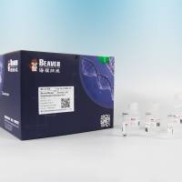 Protein A/G 免疫沉淀试剂盒