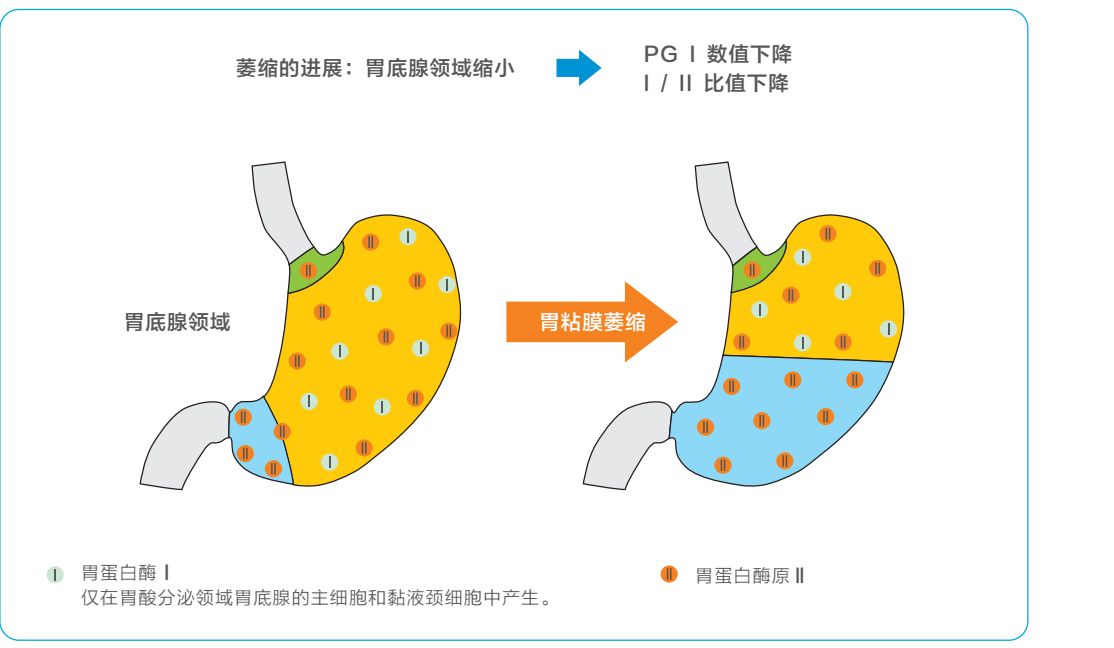 胃蛋白酶原Ⅱ检测试剂盒（荧光免疫层析法）