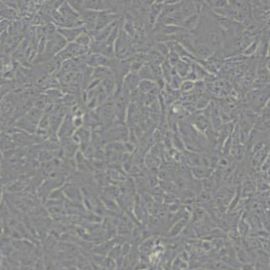 DLD-1人结直肠腺癌上皮细胞(带STR鉴定)