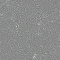 DLD-1人结直肠腺癌上皮细胞(带STR鉴定)