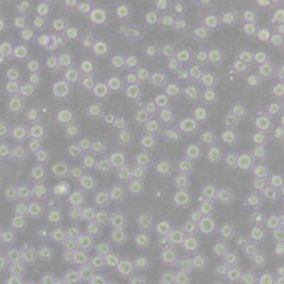 CCRF-CEM [CCRF CEM]人急性淋巴细胞白血病T淋巴细胞(带STR鉴定)