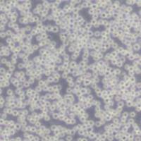 Daudi 人Burkitt's淋巴瘤细胞(带STR鉴定)