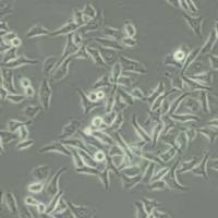 CNE人鼻咽癌细胞(带STR鉴定)