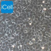 ID8+luc 小鼠卵巢上皮癌细胞荧光素酶标记