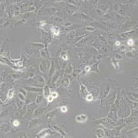 DU145人前列腺癌细胞(带STR鉴定)