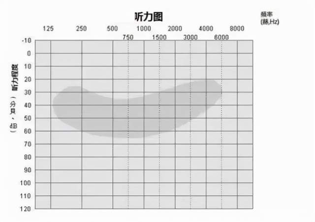 当心！全球 15 亿人正遭受听力损失困扰