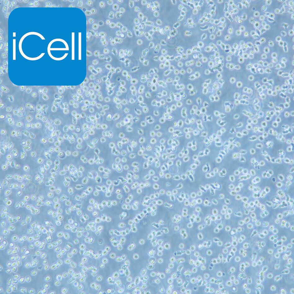 Jeko-1 人套细胞淋巴瘤细胞 STR鉴定