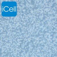 Jeko-1、Jeko-1细胞、Jeko1细胞、Jeko1、人套细胞淋巴瘤细胞/STR鉴定/镜像绮点（Cellverse）