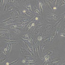 Caki-1 (人肾透明细胞癌皮肤转移细胞)带鉴定