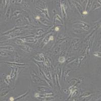 Caki-1 (人肾透明细胞癌皮肤转移细胞)带鉴定