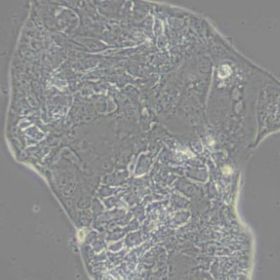 Calu-3人肺腺癌细胞(胸水)带鉴定