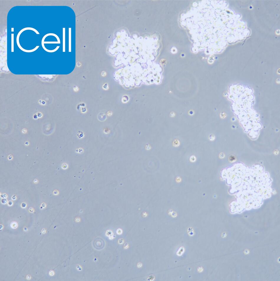 SHP-77 人小细胞肺癌细胞/STR鉴定/镜像绮点（Cellverse）