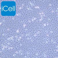 9L/lacZ细胞、9L-lacZ细胞、9L-lacZ、9LlacZ、大鼠胶质肉瘤细胞/种属